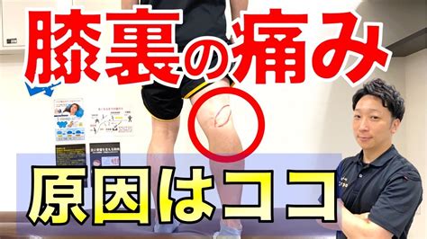 膝裏の痛みの原因は〇〇！短時間で解決する方法を徹底解説 Youtube