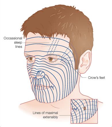 Forehead and Temple | Clinical Gate