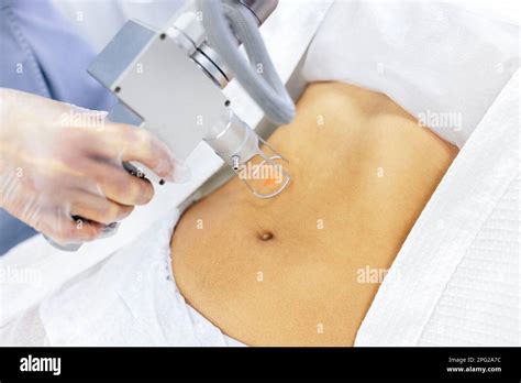 Removing Scars With Laser Extreme Close Up Of Hand Of Doctor Or