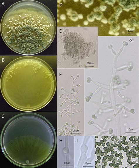 Morphological Characteristics Of Trichoderma Texanum Ac Cultures On