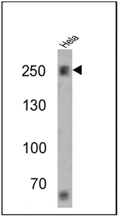 SPTBN1 Monoclonal Antibody 4C3 Invitrogen 100 μL Unconjugated