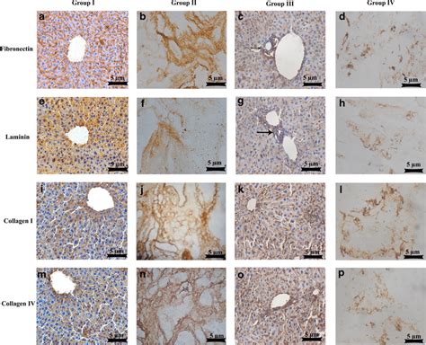 Immunohistochemical Analysis Of Normal And Injured Liver By Fibronectin