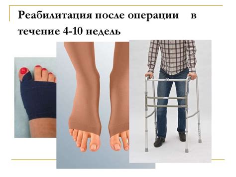 Плоскостопие. Причины, виды, лечение и профилактика - презентация онлайн