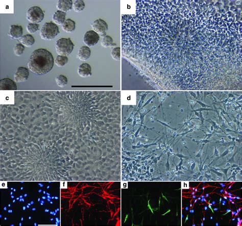 Bright Field Panel Of Neural Differentiation A Embryoid Bodies 4 Days