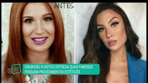 Antes E Depois Da Boca Rosa Bianca Andrade Fez Quais Cirurgias