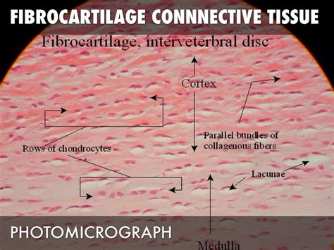 Fibrocartilage Under Microscope Labeled Micropedia