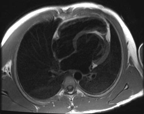 Cmr Course In Preparation Cardiovascular Imaging