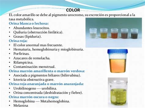 Examen General De Orina