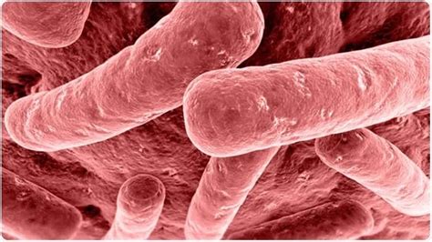 Medical Terms & Сlinical Сases : Botulism