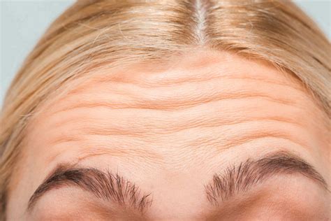 Understanding The Different Types Of Wrinkles Reviva Labs