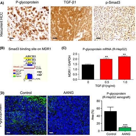 AANG Overcomes Pglycoprotein Mediated Multidrug Resistance Of