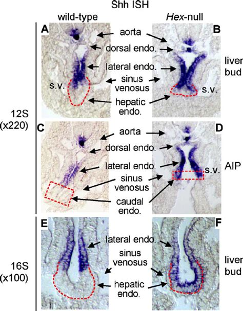 Ectopic Shh Expression In Hex Null Embryos A To B Whole Mount In