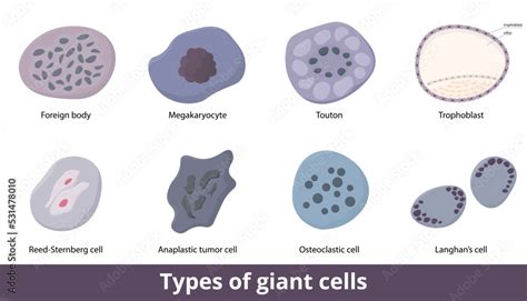 Types of giant cells. Eight types of giant cells include Langhan's ...