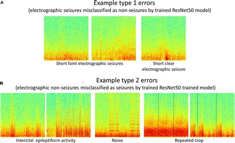 Frontiers A High Accuracy Electrographic Seizure Classifier Trained