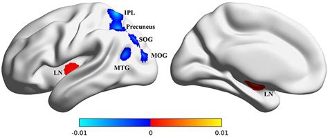 Frontiers Aberrant Pattern Of Regional Cerebral Blood Flow In Mild