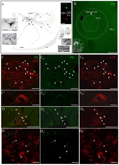 Avp Containing Magnocellular Neurons Innervate The Cea A Camera