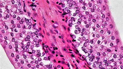 Transitional Epithelium Histology