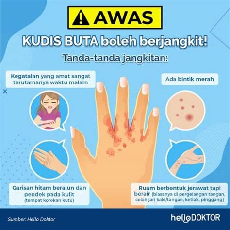 Cara Nak Hilangkan Kudis Buta