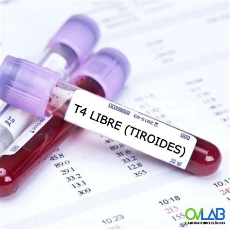 T4 LIBRE – OVLAB – O&V Laboratorios