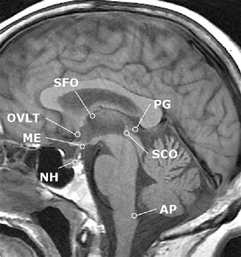 Area Postrema Mri Anatomy