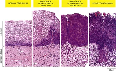 Cancer Biology Basicmedical Key