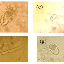 A Hookworm Eggs B Enterobius Vermicularis Eggs C Giardia Cysts