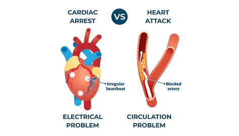 Difference Between Heart Attack And Cardiac Arrest Apex Hospitals