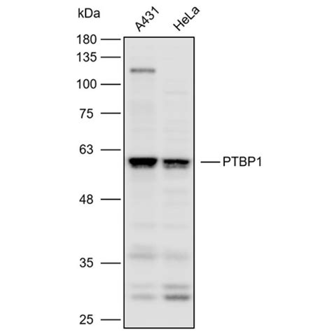 Solarbio K P Anti Ptbp Polyclonal Antibody