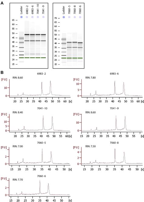 Quality Control Assay Of Rnas Used For Microarrays A Bioanalyzer