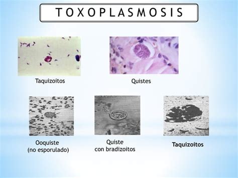 Toxoplasmosis Pptx