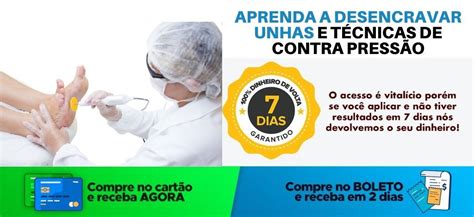 F Rmula Podologia De Sucesso Aprenda A Desencravar Unhas T Cnicas