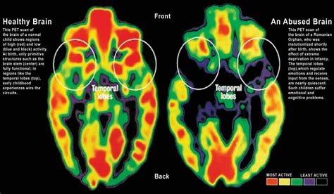 How Do Early Attachment Relationships Impact The Brain Evergreen