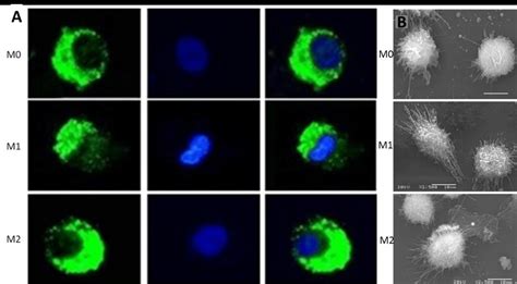 Analysis Of Macrophage Morphology Upon Different Activation Methods