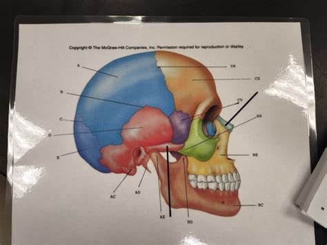 Lab Practical Lateral Bones And Features Of The Skull Flashcards