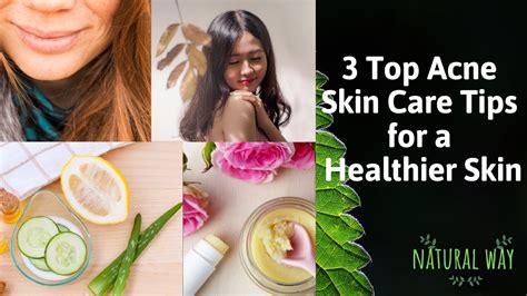 3 Top Acne Skin Care Tips For A Healthier Skin Youtube