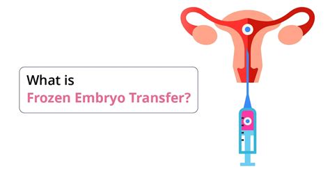 Frozen Embryo Transfer Process Step By Step Guide