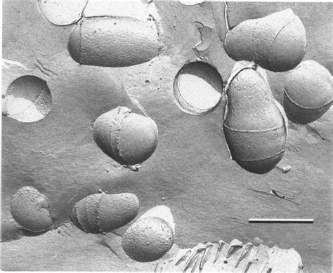 Freeze Fracture Electron Micrograph Of Cells From A H Old Culture