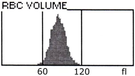 Histogramm Des Erythrozytenvolumens Doccheck