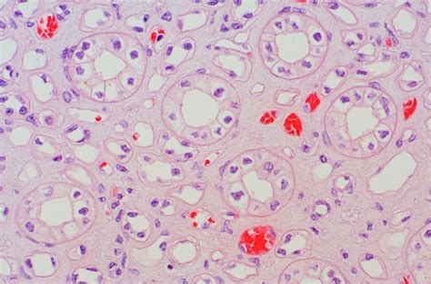 Kidney Medulla Histology