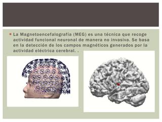 Eeg Magneto Encefalograma Ppt