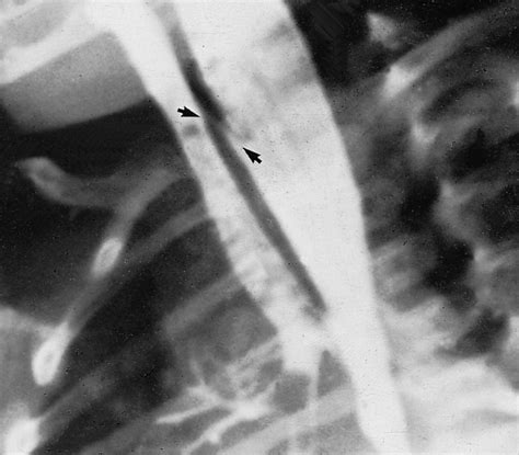 Paediatric Gastrointestinal Disorders Clinical Tree