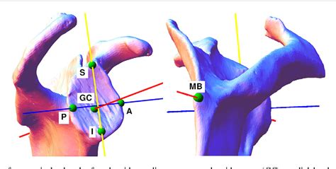 Figure 1 From Glenoid Morphology After Reaming In Computer Simulated