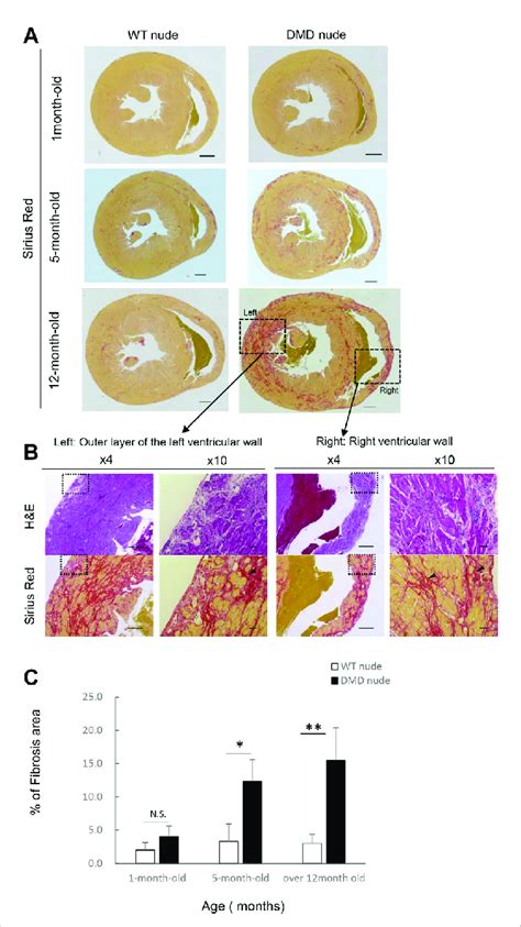 Severe And Progressive Muscle Changes In The Heart Of DMD Nude Rats