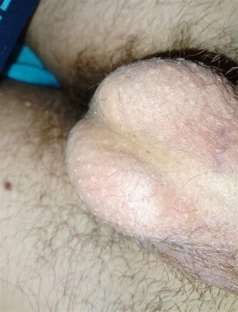 Cock Balls 7 Nude Pics XHamster