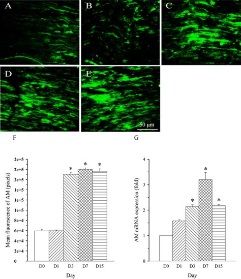 Expression Pattern Of AM Protein And MRNA In L5 Spinal Nerve In SNL