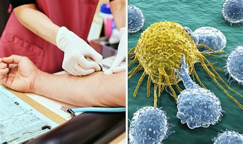 New Nhs Blood Test Could Detect More Than 50 Types Of Cancers Before