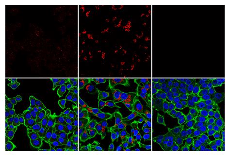 LC3B E5Q2K Mouse MAb Alexa Fluor 647 Conjugate Cell Signaling