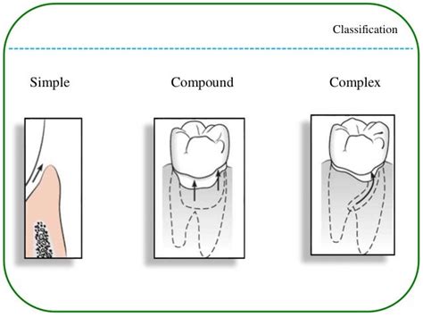 Periodontal pockets