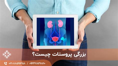 بزرگی پروستات چیست؟ علائم، تشخیص، آزمایش‌ها و درمان کلینیک اورولوژی الهام