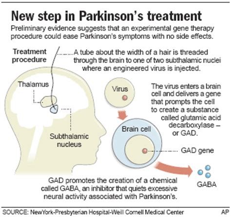 Gene Therapy Eases Parkinson S Symptoms Health Health Care More